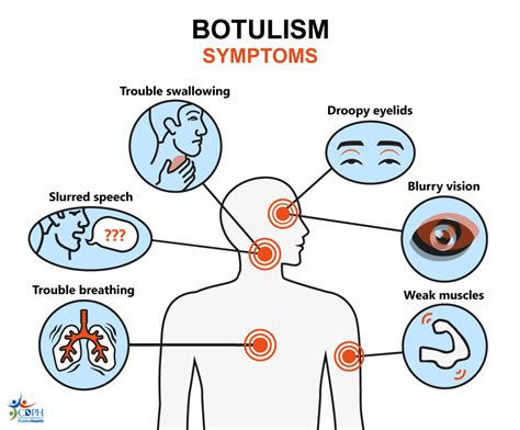 signs of botulism poisoning